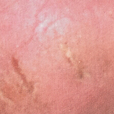 Photo taken after using body powder