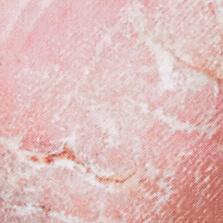 Photo taken before using body powder