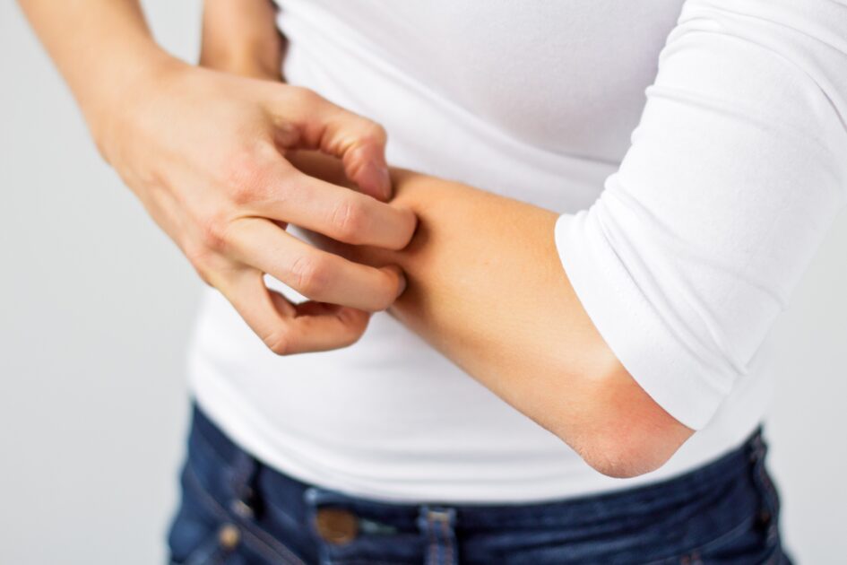 An insight into itchy skin and how to help to prevent it
